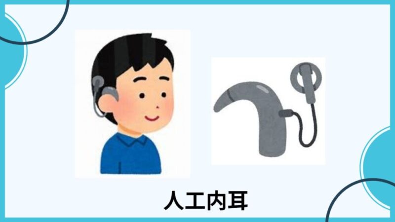 人工内耳の成功率はどれくらいですか?