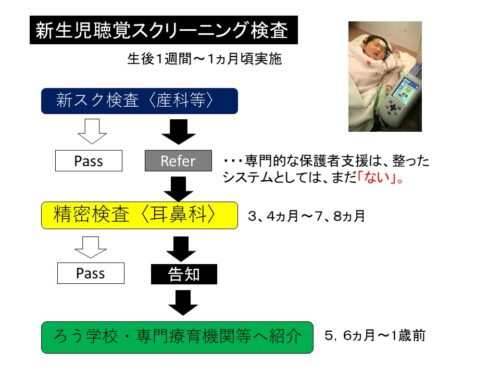 新生児聴覚スクリーニングってどんな検査？ 難聴児支援教材研究会